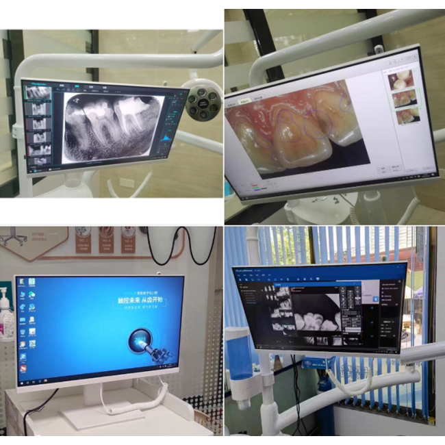 Dentalisches WLAN All-in-One-Intraorale Camera mit 24-Zoll-Touchscreen